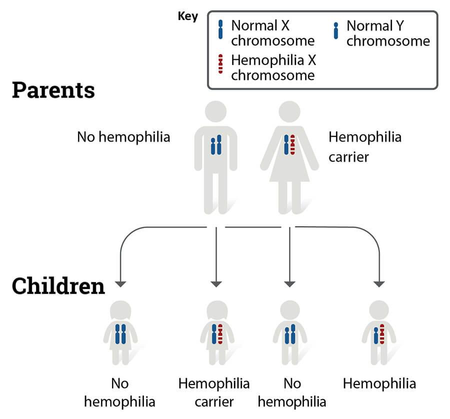 Hemophilia